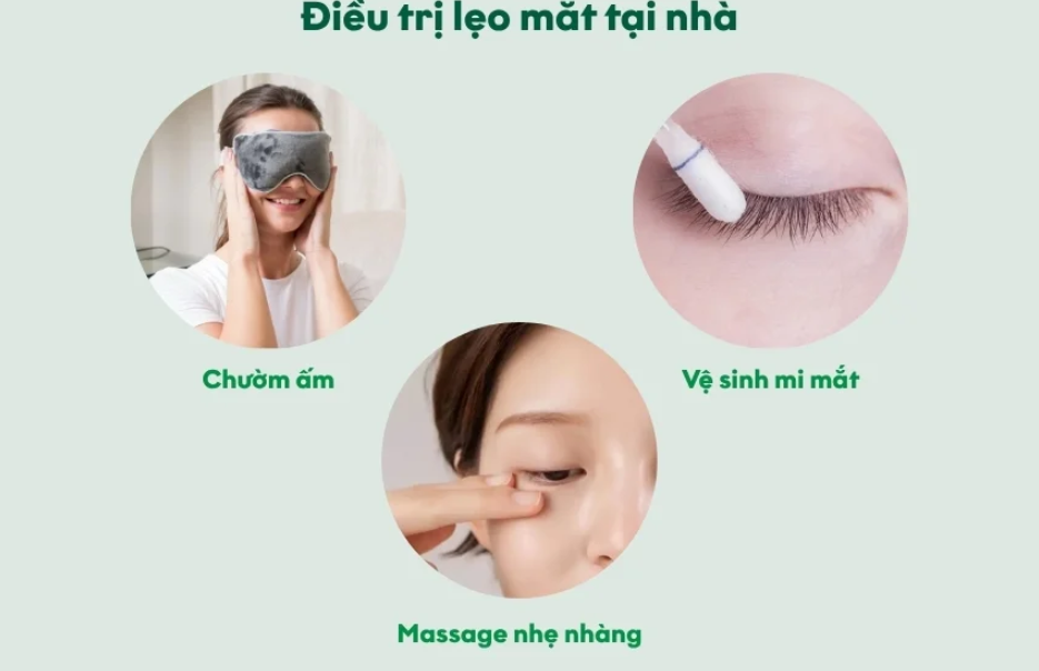 lẹo mắt 